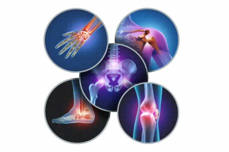 cartilago articular